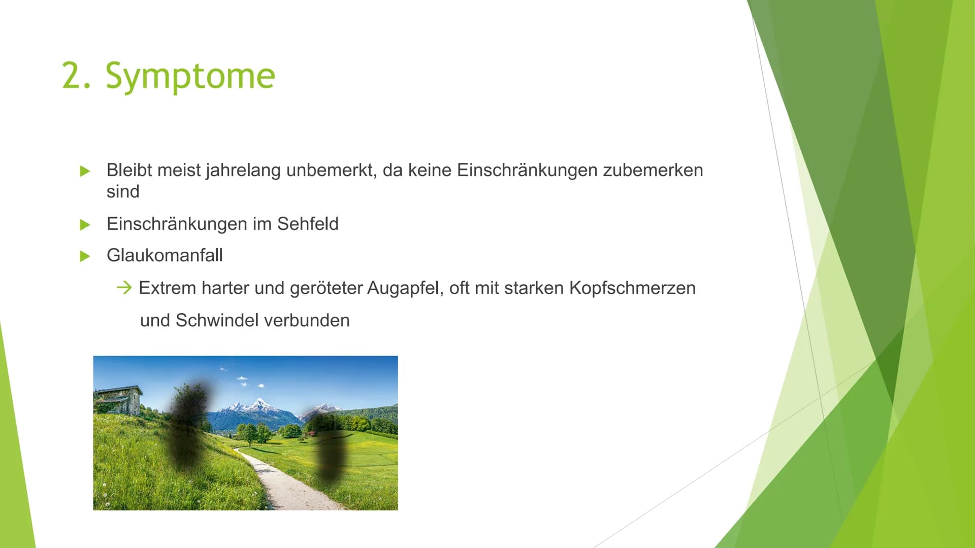 Der grüne Star
(Glaukom) Gliederung
1. Was ist ein Glaukom
2. Symptome
3. Arten von Glaukomen
4. Entstehung
5. Behandlung
6. Quellen
Geschäd