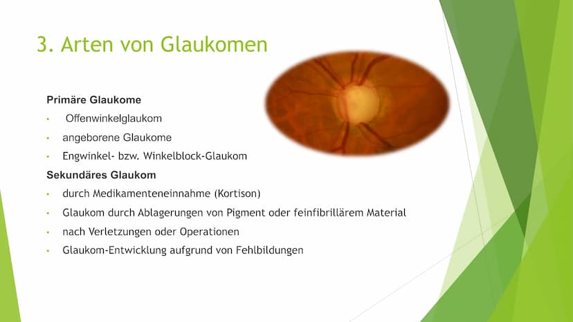 Der grüne Star
(Glaukom) Gliederung
1. Was ist ein Glaukom
2. Symptome
3. Arten von Glaukomen
4. Entstehung
5. Behandlung
6. Quellen
Geschäd