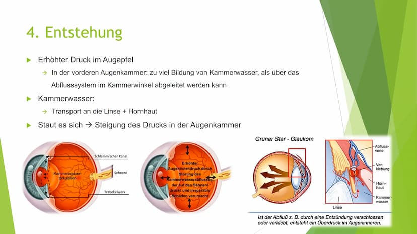 Der grüne Star
(Glaukom) Gliederung
1. Was ist ein Glaukom
2. Symptome
3. Arten von Glaukomen
4. Entstehung
5. Behandlung
6. Quellen
Geschäd