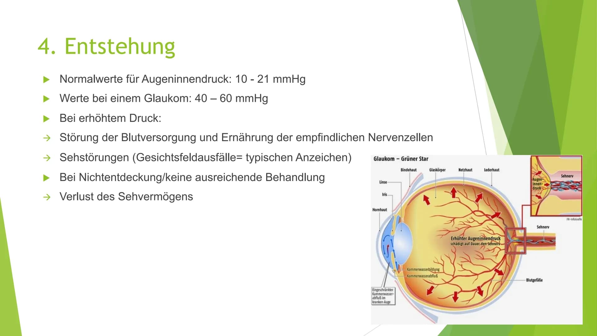 Der grüne Star
(Glaukom) Gliederung
1. Was ist ein Glaukom
2. Symptome
3. Arten von Glaukomen
4. Entstehung
5. Behandlung
6. Quellen
Geschäd