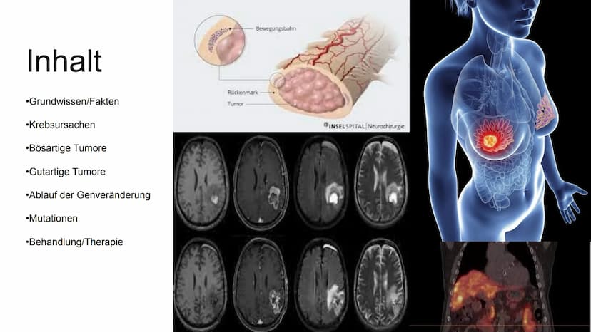 Chemotherapy
-die zweithäufigste Todesursache in Deutschland-
Mechaniche
Tumor
305
Methoden
Operation
Chemische
accuracy and diversity of mo