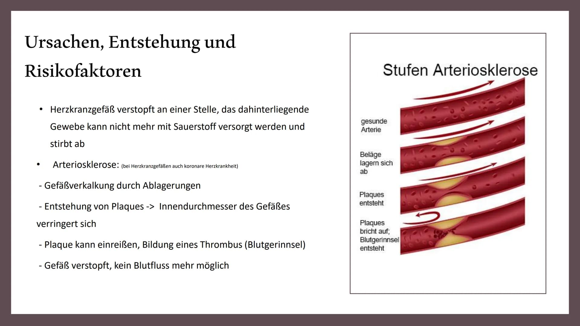 Herzinfarkt Definition
Erste Hilfe
Gemeinsamkeiten Herzinfarkt
und Schlaganfall
INHALT
Vorbeugung
Symptome
Behandlung
Ursachen und
Risikofak