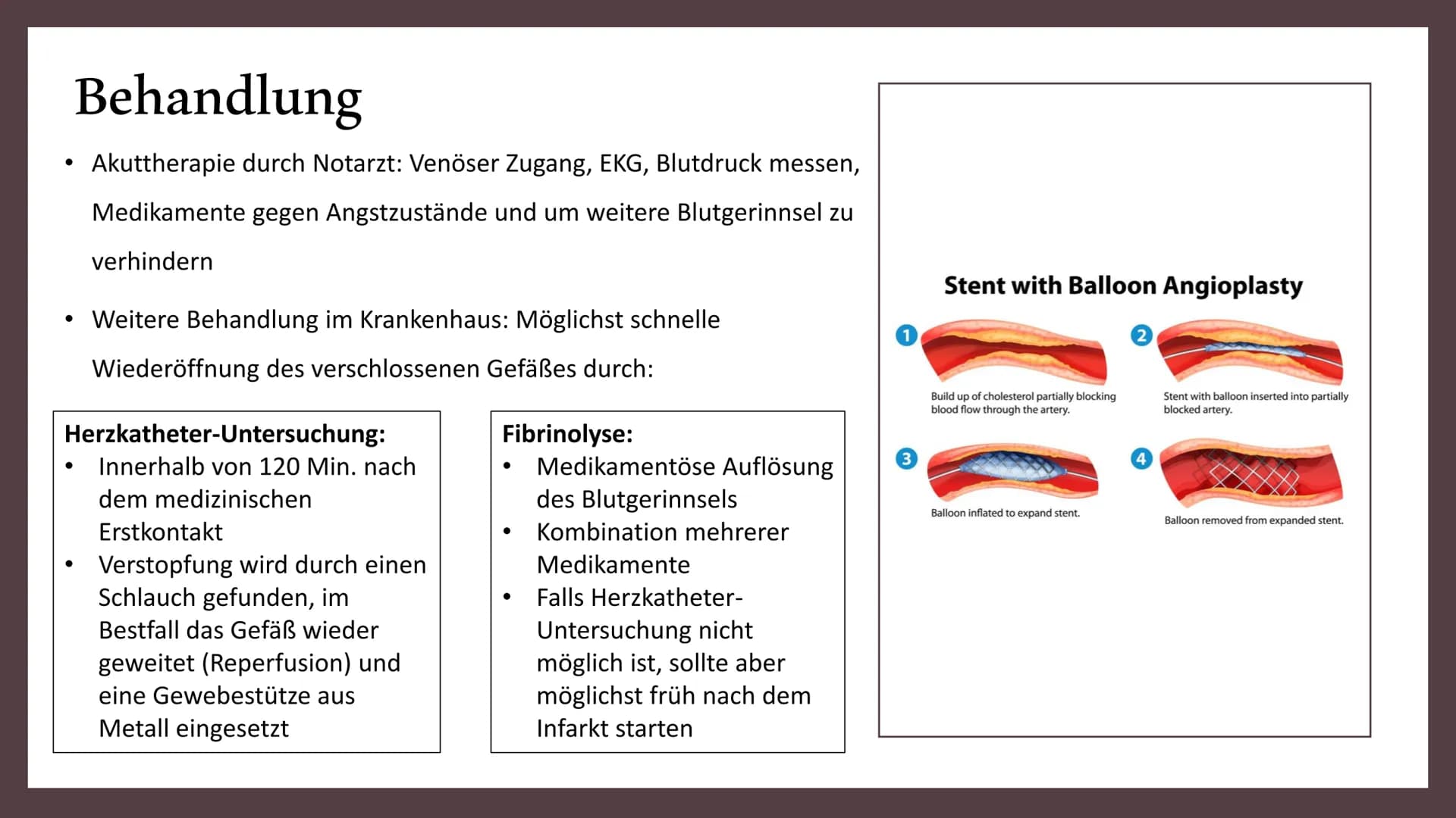 Herzinfarkt Definition
Erste Hilfe
Gemeinsamkeiten Herzinfarkt
und Schlaganfall
INHALT
Vorbeugung
Symptome
Behandlung
Ursachen und
Risikofak