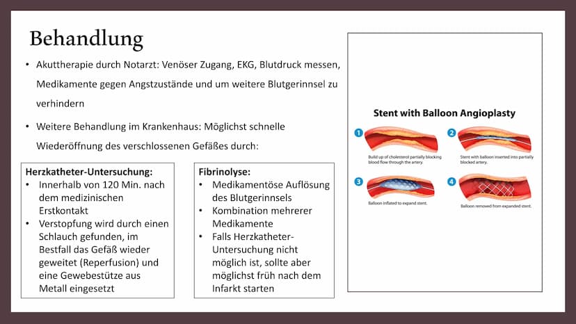 Herzinfarkt Definition
Erste Hilfe
Gemeinsamkeiten Herzinfarkt
und Schlaganfall
INHALT
Vorbeugung
Symptome
Behandlung
Ursachen und
Risikofak