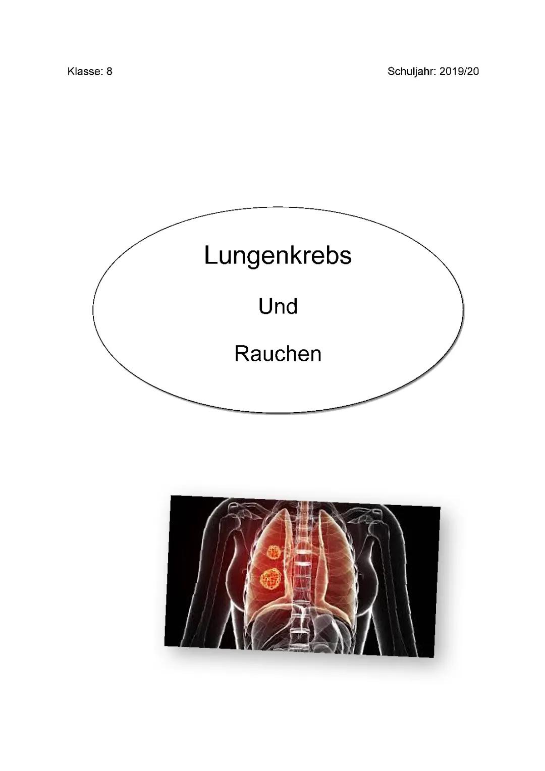 Alles über Lungenkrebs: Ursachen, Symptome und wie man rauchen kann vermeiden