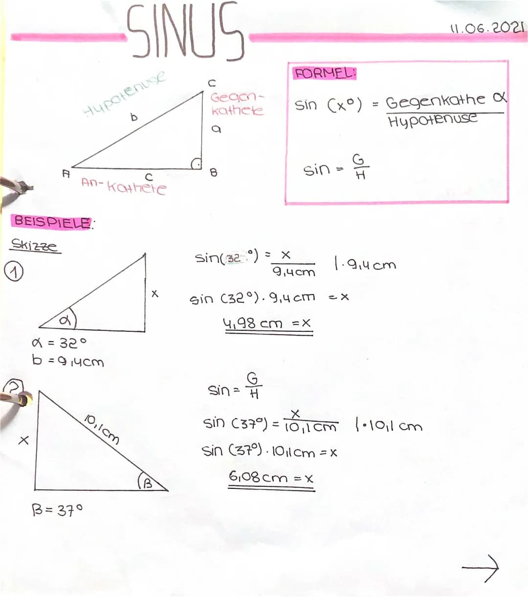 Sinus