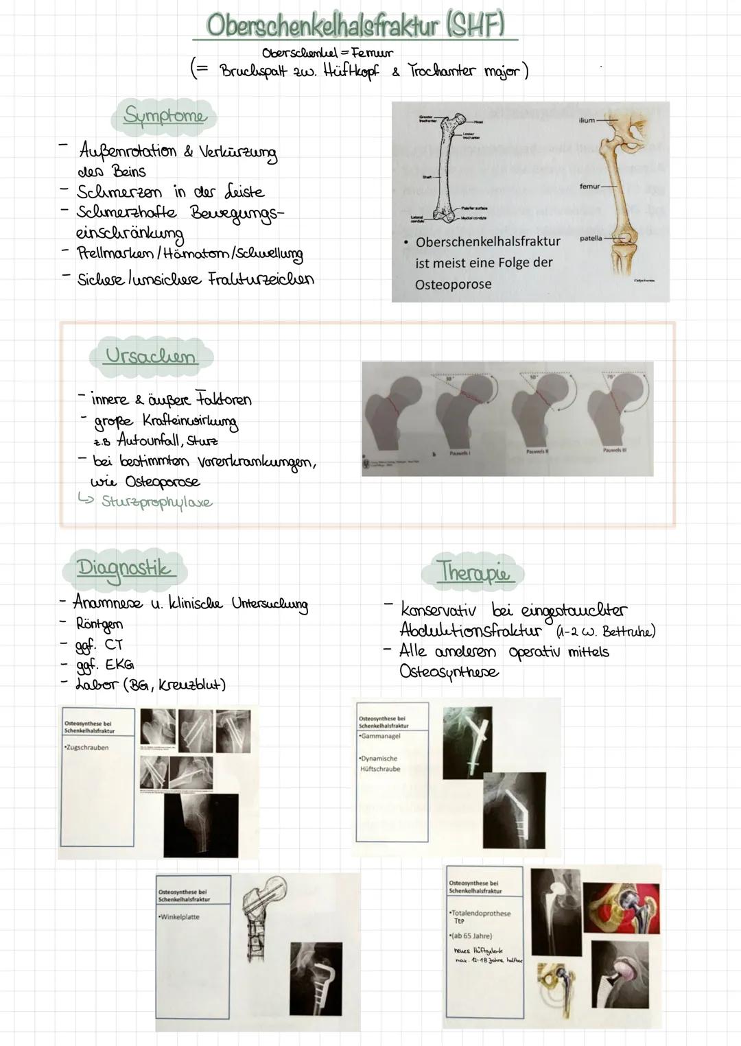 Oberschenkelhalsfraktur
(SHF)
Oberschenkel-Femur
(= Bruchspalt zw. Hüftkopf & Trochanter major)
Symptome
Außenrotation & Verkürzung
des Bein