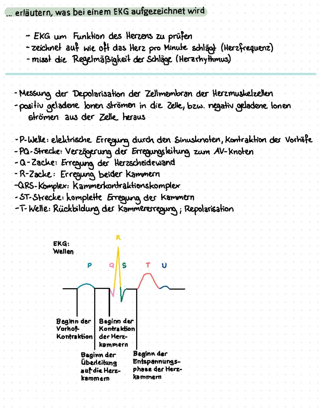 EKG