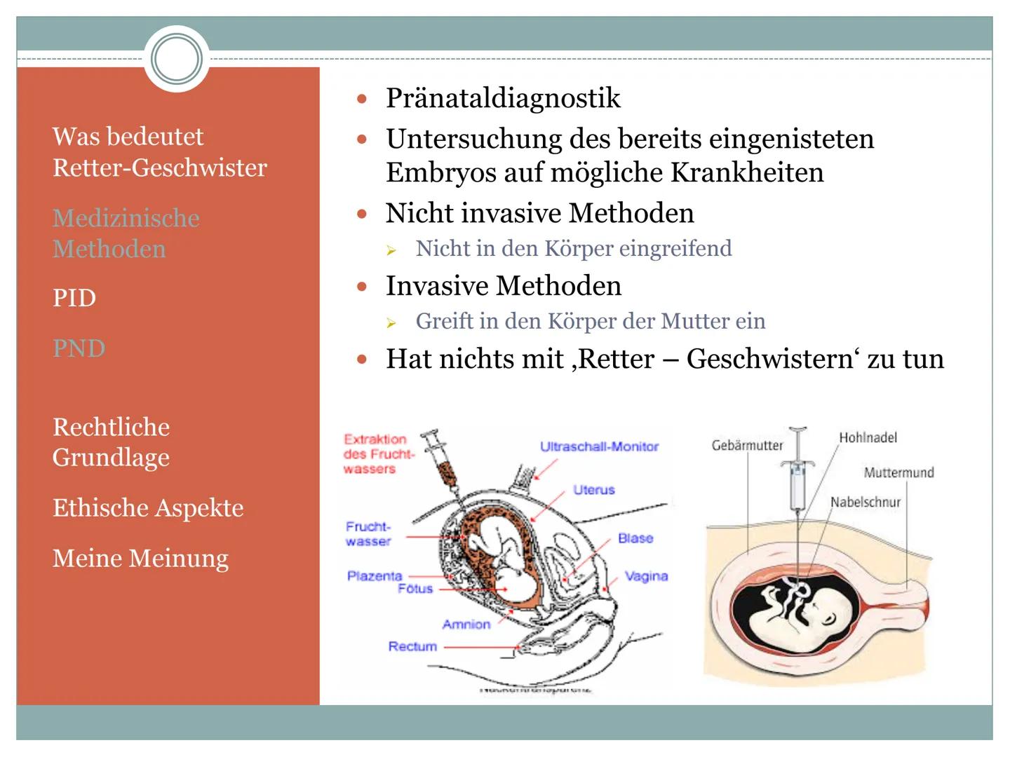 Retter - Geschwister
ETHISCH VERTRETBAR ?
Beim Leben
meiner Schwester
hoon diar
gal trean
O
95826419 1 GFS Ethik
Retter Geschwister
Ethisch 