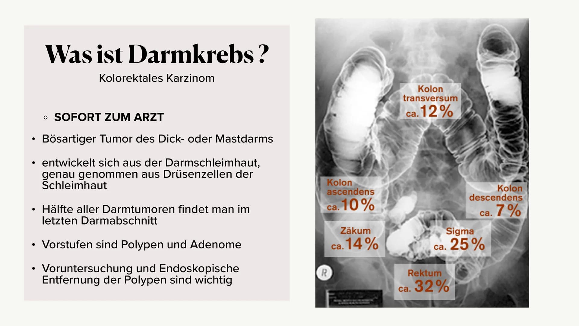 Krankheitsbild (Dick-)Darmkrebs
und die Vorsorgeuntersuchung
(Rektoskopie / Koloskopie)
Alina Hach 30.04.2020 (Dick-)
Darmkrebs
Kolorektales
