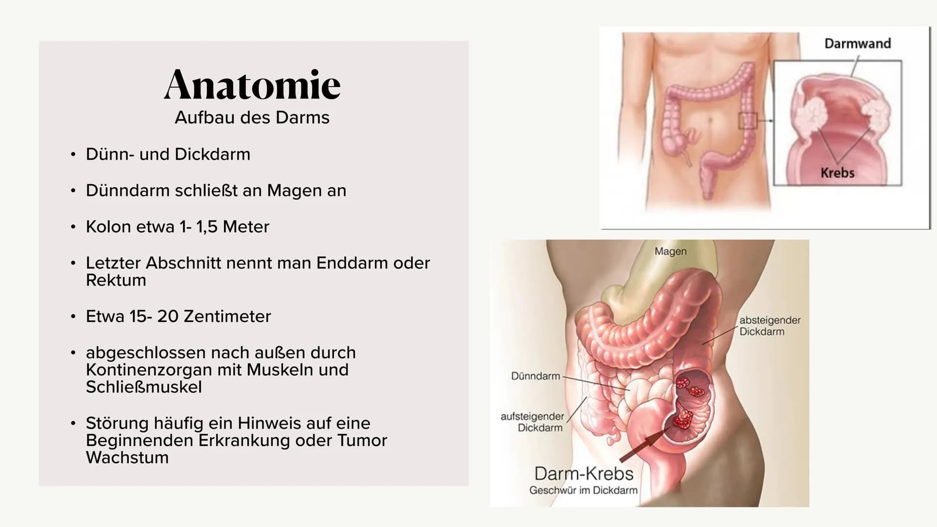 Krankheitsbild (Dick-)Darmkrebs
und die Vorsorgeuntersuchung
(Rektoskopie / Koloskopie)
Alina Hach 30.04.2020 (Dick-)
Darmkrebs
Kolorektales