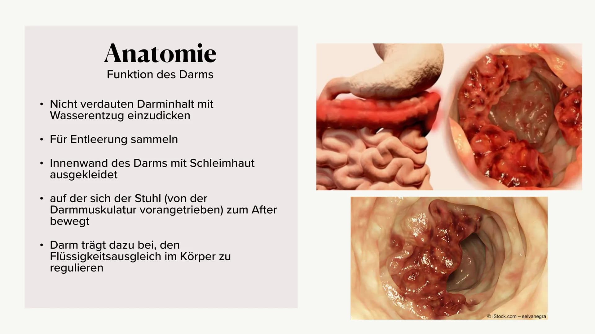 Krankheitsbild (Dick-)Darmkrebs
und die Vorsorgeuntersuchung
(Rektoskopie / Koloskopie)
Alina Hach 30.04.2020 (Dick-)
Darmkrebs
Kolorektales