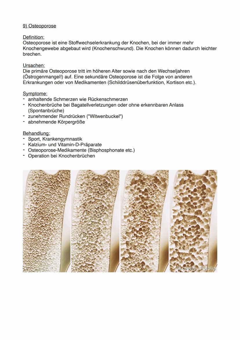 
<p><strong>Mimische Muskulatur</strong></p>
<ul>
<li>Deltamuskel (M. deltoideus)</li>
<li>Großer Brustmuskel (M. pectoralis major)</li>
<li