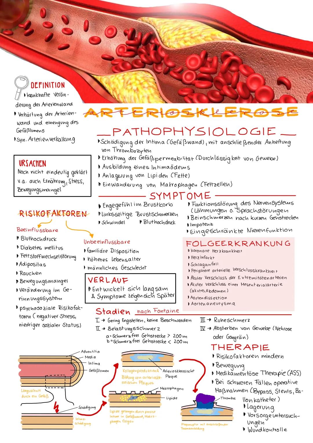 # DEFINITION
*   krankhafte verän -
derung der Arterienwand
*   Verhärtung der Arterien
wand und einengung des
Gefäßlumens
*   Syn. Arterien