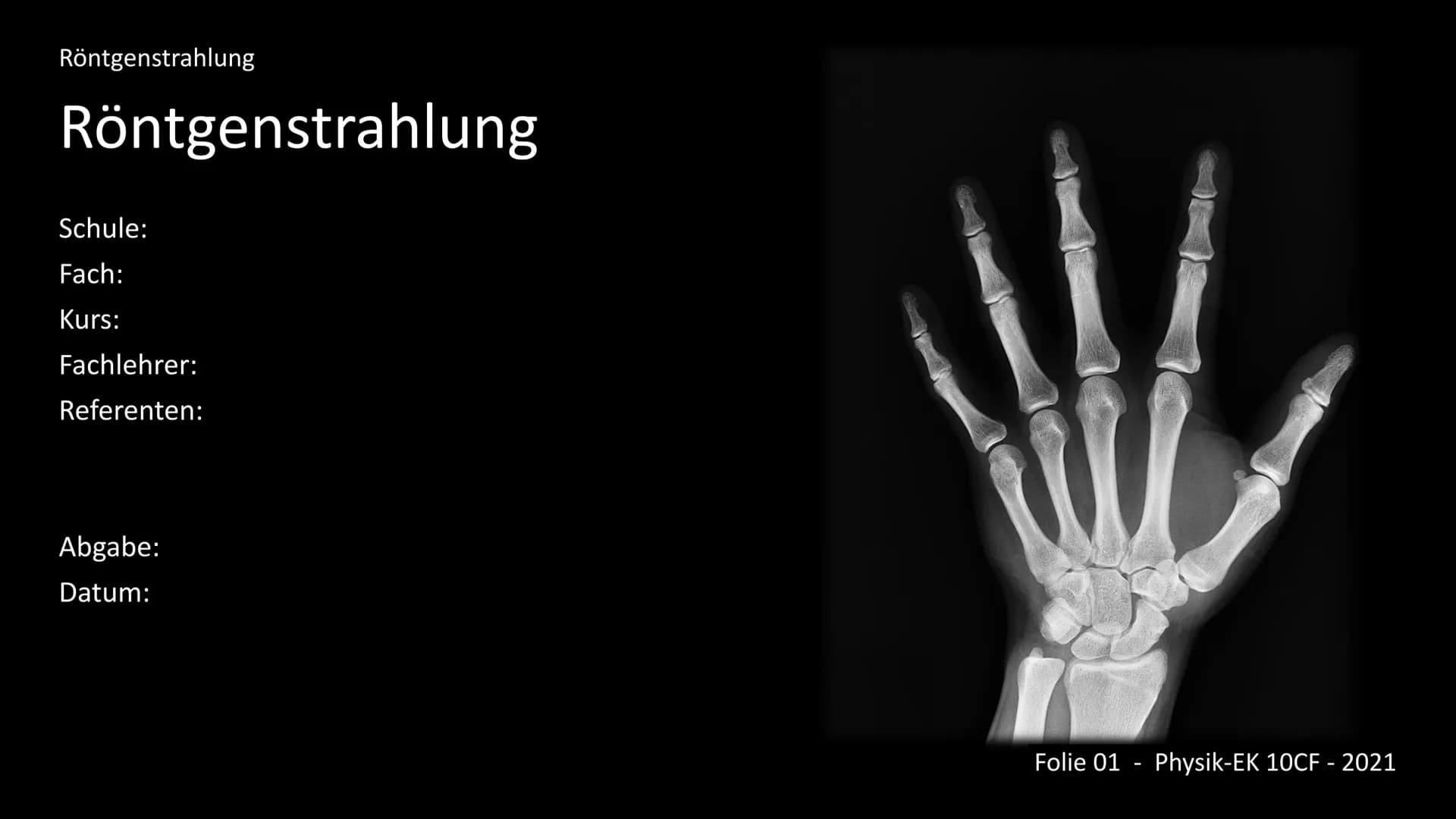 Die Röntgenstrahlung
-Kurzfassung-
Inhalt:
1. Einleitung - Was ist Röntgenstrahlung?
2. Entdeckungsgeschichte
3. Entstehung
4. Wechselwirkun