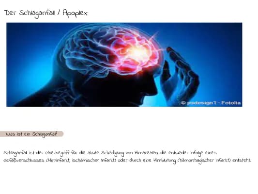Know Schlaganfall / Apoplex thumbnail