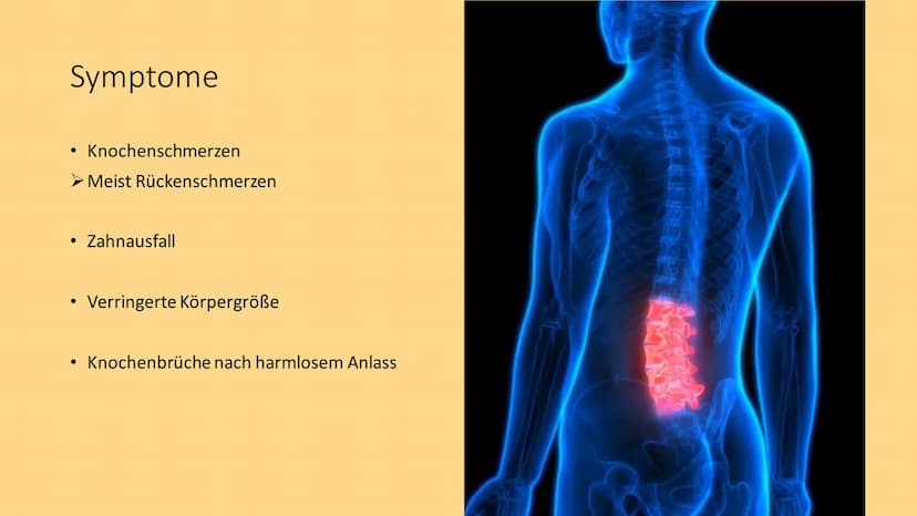 OSTEOPOROSE
crevis- Fotolia INHALTSVERZEICHNIS
• Definition
• Wer ist betroffen?
Symptome
• Die Knochen - Übersicht
●
• Die Knochensubstanz
