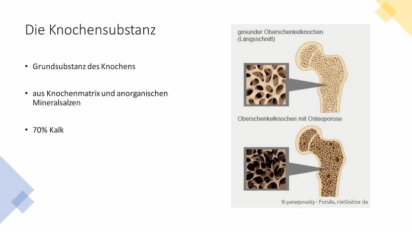 OSTEOPOROSE
crevis- Fotolia INHALTSVERZEICHNIS
• Definition
• Wer ist betroffen?
Symptome
• Die Knochen - Übersicht
●
• Die Knochensubstanz
