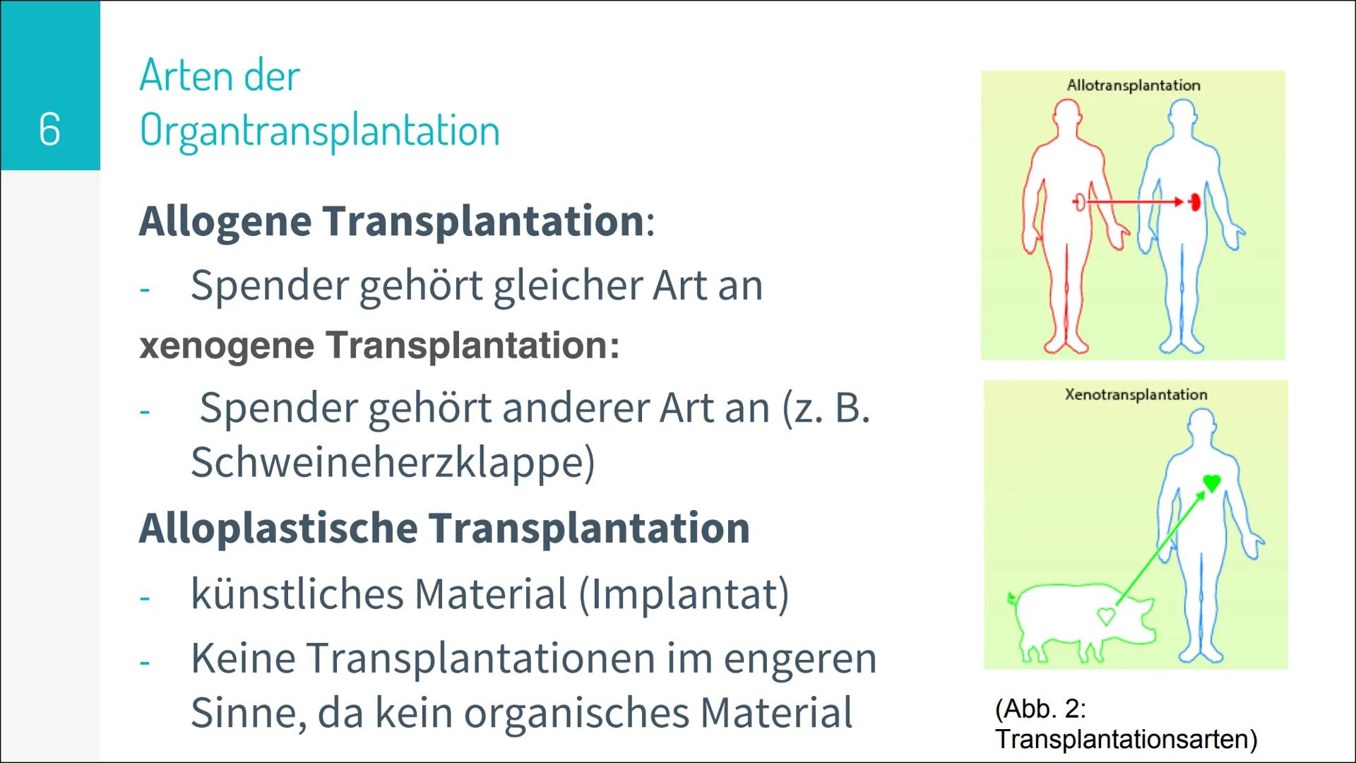 ORGAN TRANSPLANTATION 2
Gliederung
▸ Organtransplantation
Arten der Organtransplantation
Ablauf und Folgen
Immunreaktion
Organspende
Vorraus