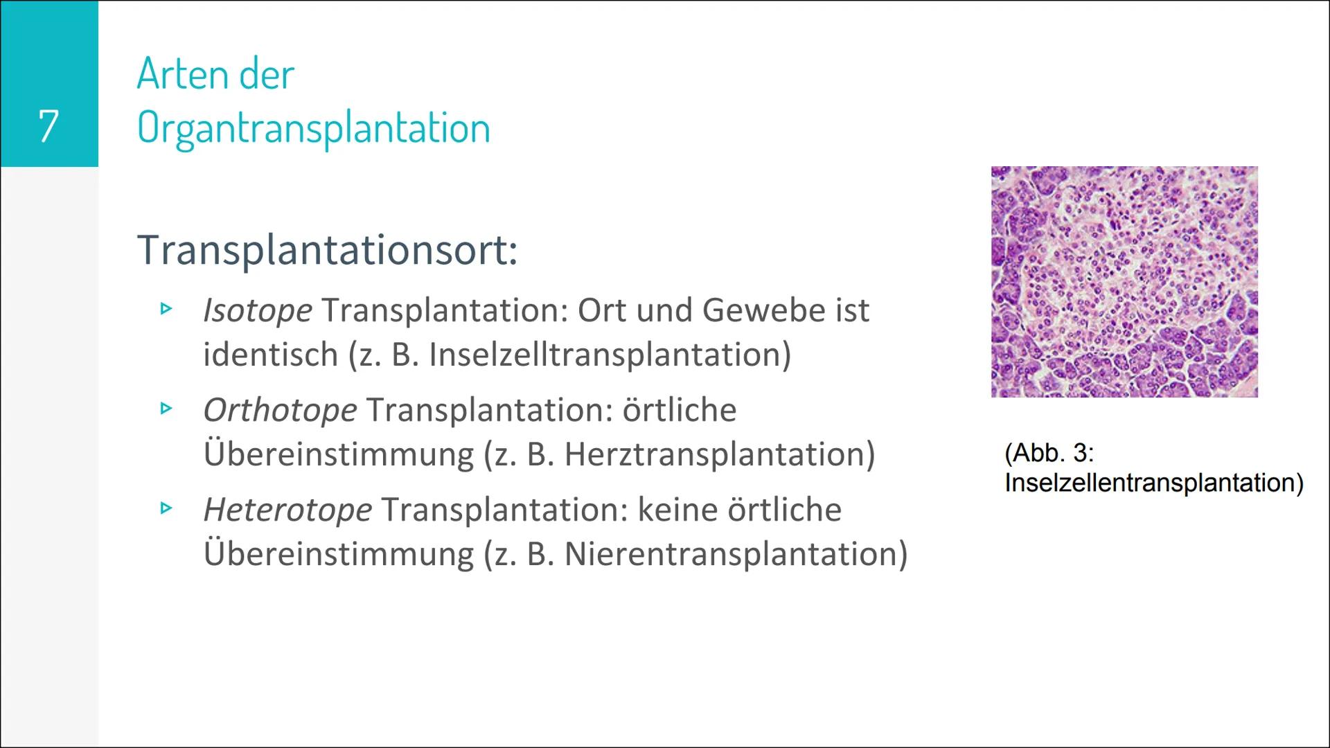 ORGAN TRANSPLANTATION 2
Gliederung
▸ Organtransplantation
Arten der Organtransplantation
Ablauf und Folgen
Immunreaktion
Organspende
Vorraus