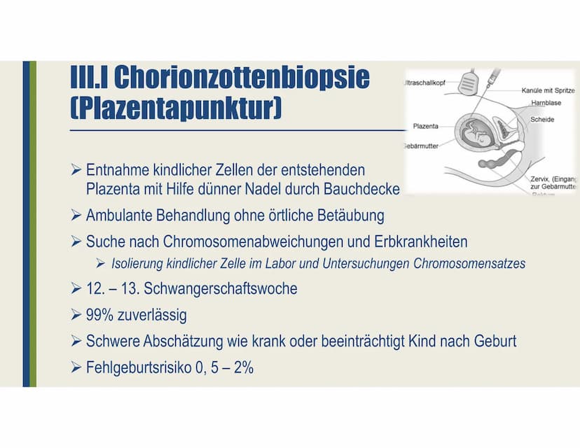 Pränataldiagnostik
Ein Vortrag von Laura-Sophie Döring
https://www.youtube.com/watch?v=jJNkwjH8uQ8 Gliederung
I. Allgemeines
II. Nicht-Invas