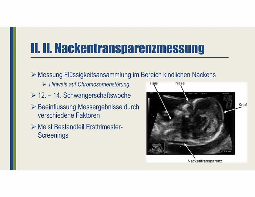 Pränataldiagnostik
Ein Vortrag von Laura-Sophie Döring
https://www.youtube.com/watch?v=jJNkwjH8uQ8 Gliederung
I. Allgemeines
II. Nicht-Invas