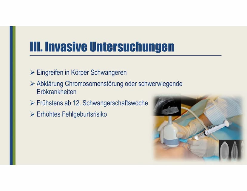 Pränataldiagnostik
Ein Vortrag von Laura-Sophie Döring
https://www.youtube.com/watch?v=jJNkwjH8uQ8 Gliederung
I. Allgemeines
II. Nicht-Invas