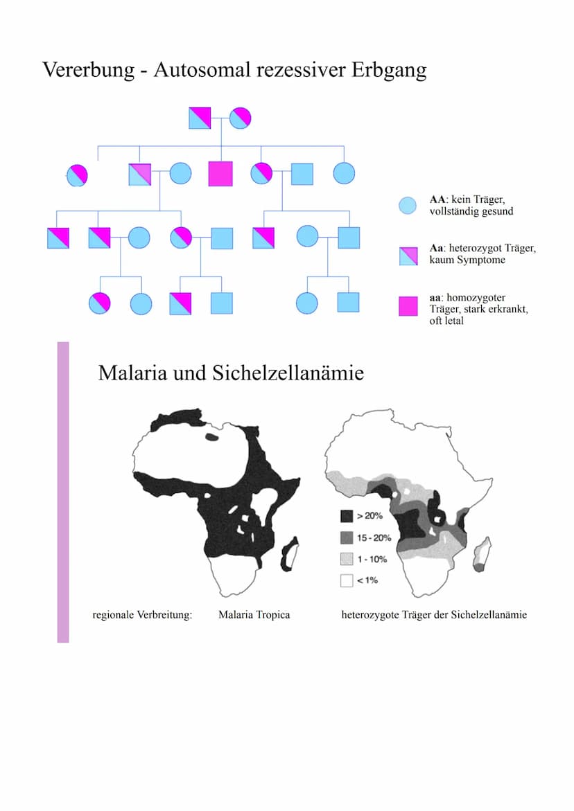 0
O
Sichelzellanämie
Definition: Die Sichelzellanämie ist eine autosomal-rezessiv
vererbte Anomalie (Unregelmäßigkeit) des Hämoglobins,
bei 
