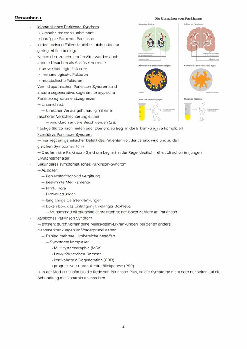 Definition:
neurologische Erkrankung
→ umgangssprachlich „Schüttellähmung"
nach dem englischen Arzt Dr. James Parkinson benannt
→ 1817 erstm