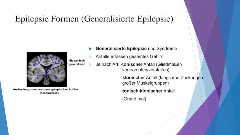 MAT
AN
Epilepsie
W Gliederung
Was ist Epilepsie?
Definition
Formen
Unterschiede im Hirn
Epileptischer Anfall
Erste Hilfe
Ursachen
Risikofakt