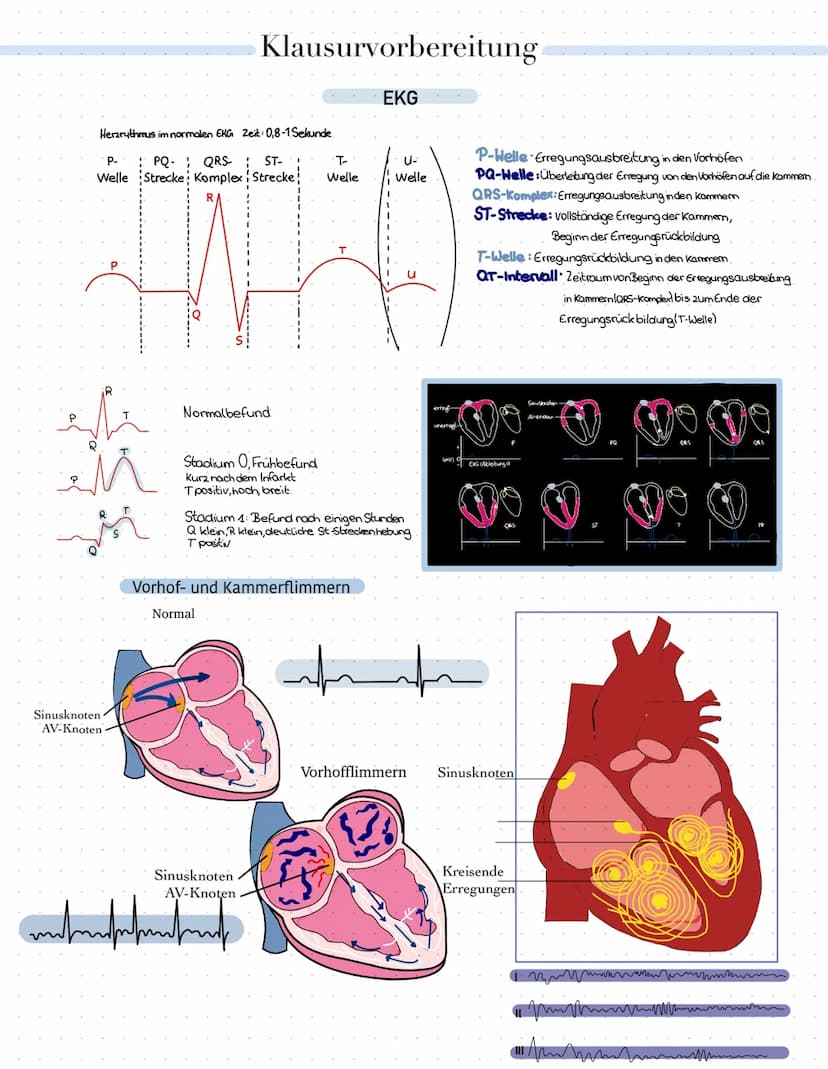 Klausurvorbereitung
Themenübersicht
•Herz-Kreislauf-System
Herzschlag
Herzerregungsweiterleitug
• EKG Kurve physiologisch und Pathologisch
A