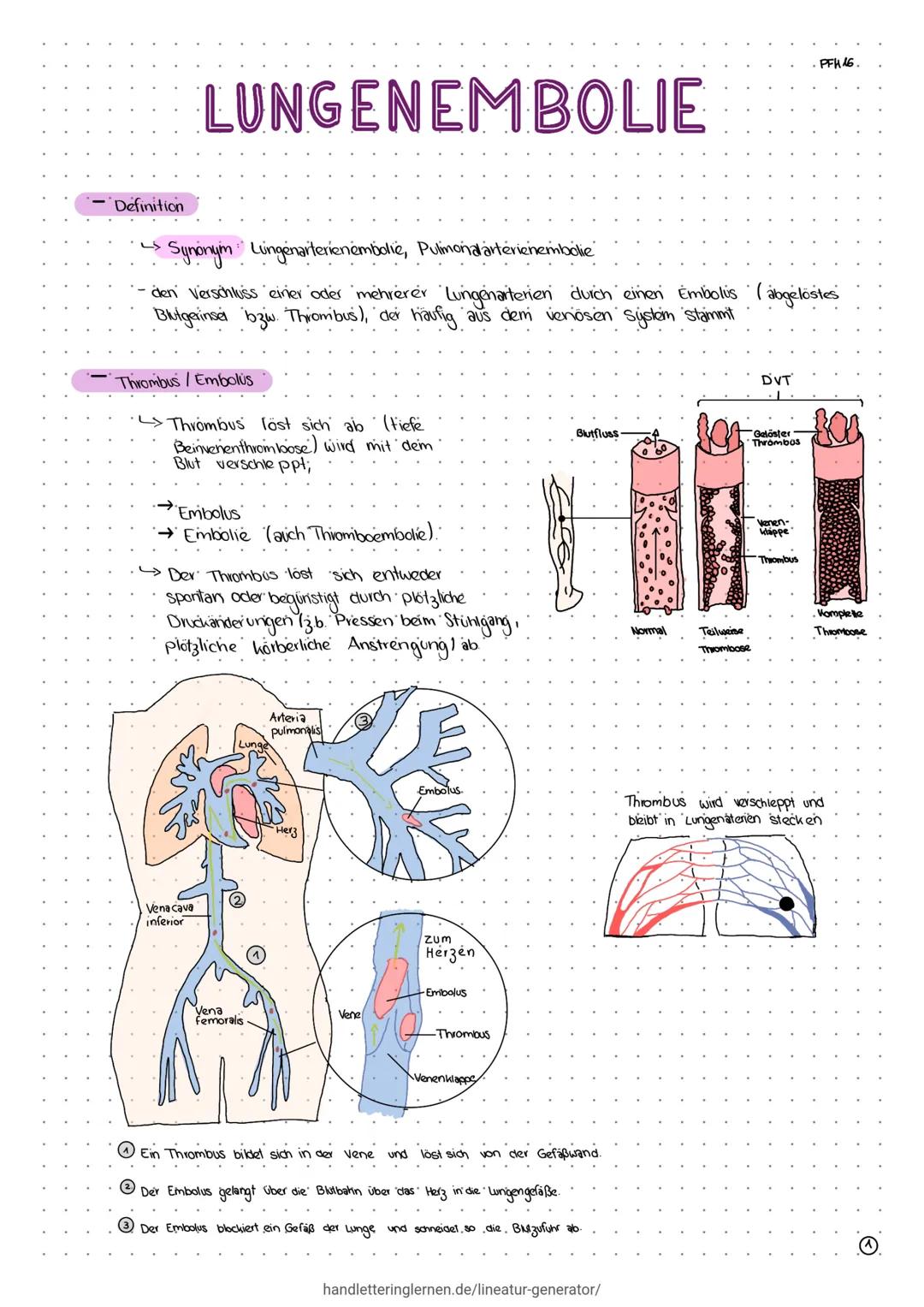 # LUNGENEMBOLIE

PFH16.

- Definition

$
\longrightarrow
$
Synonym Lungenarterienembolie, Pulmonalarterienembolie

- den Verschluss einer od