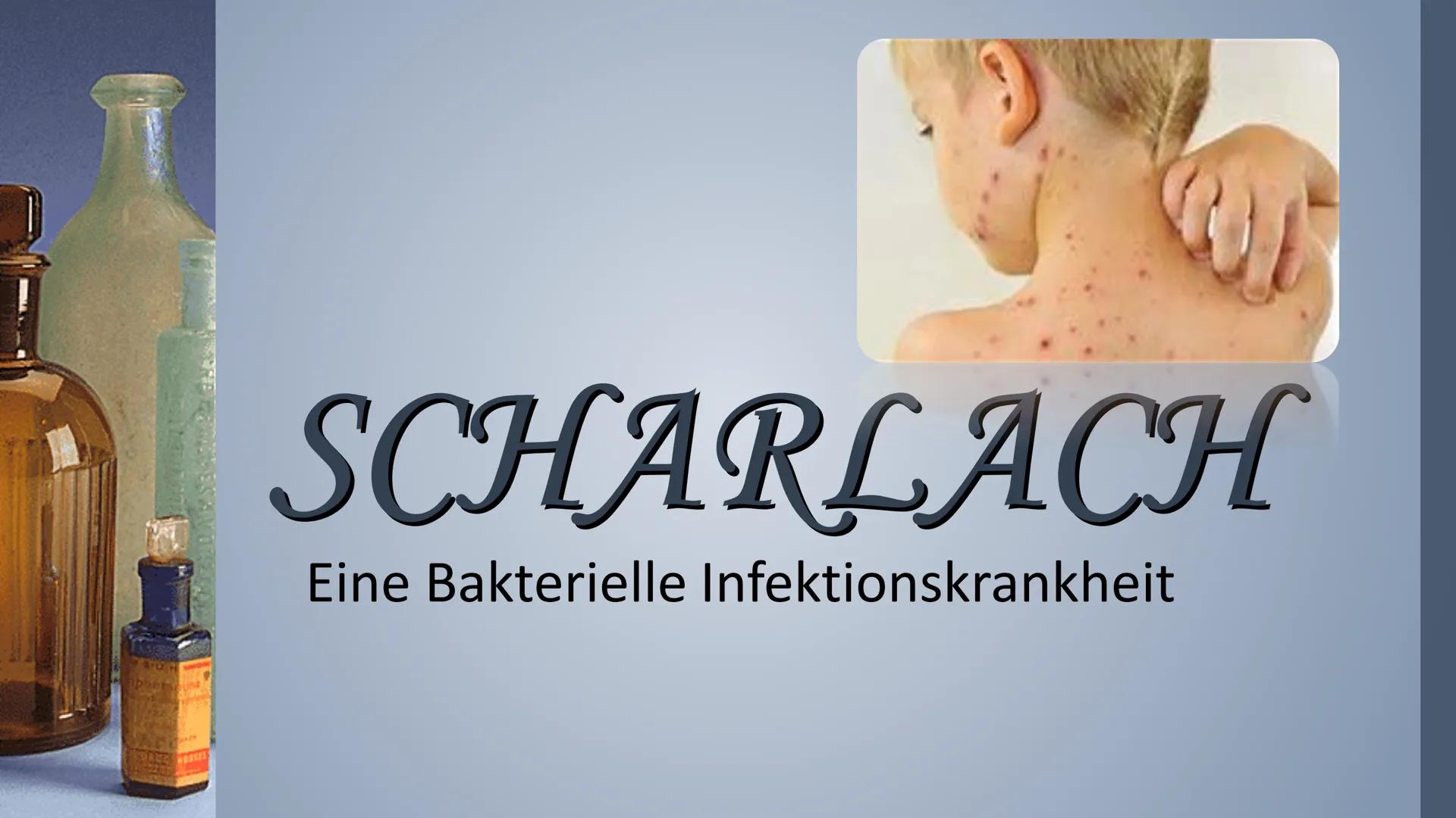 FASA
apher sou
HOSSES
SCHARLACH
Eine Bakterielle Infektionskrankheit FA33
ipher sou
Inhaltsverzeichnis
*Symptome
❖ Ansteckung
Untersuchungen