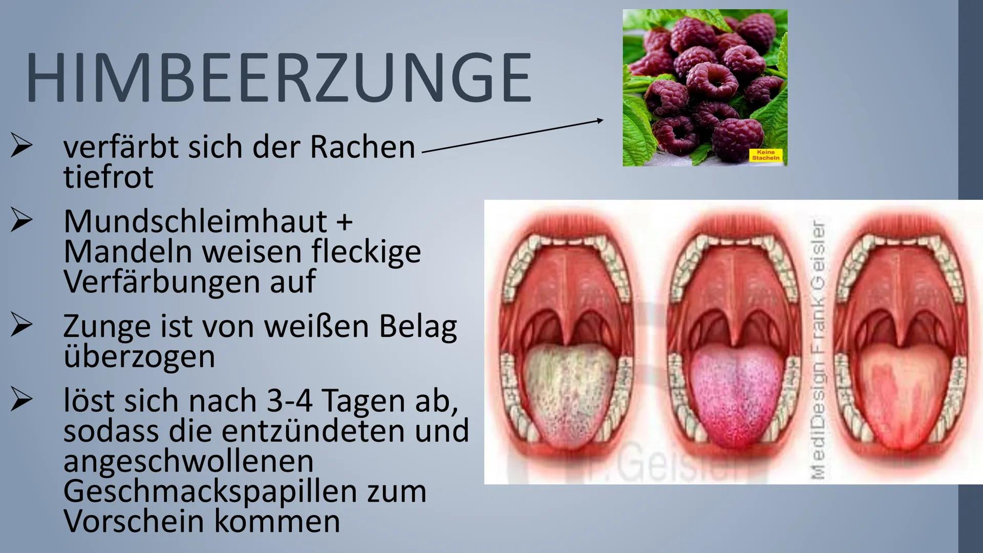 FASA
apher sou
HOSSES
SCHARLACH
Eine Bakterielle Infektionskrankheit FA33
ipher sou
Inhaltsverzeichnis
*Symptome
❖ Ansteckung
Untersuchungen