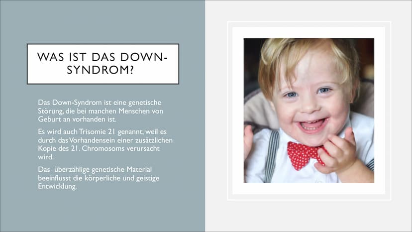 DOWN SYNDROM GLIEDERUNG
Was ist das down-syndrom?
Ursachen und diagnose
Symptome und merkmale
Therapie
Herausforderungen und Chancen
• Fakte