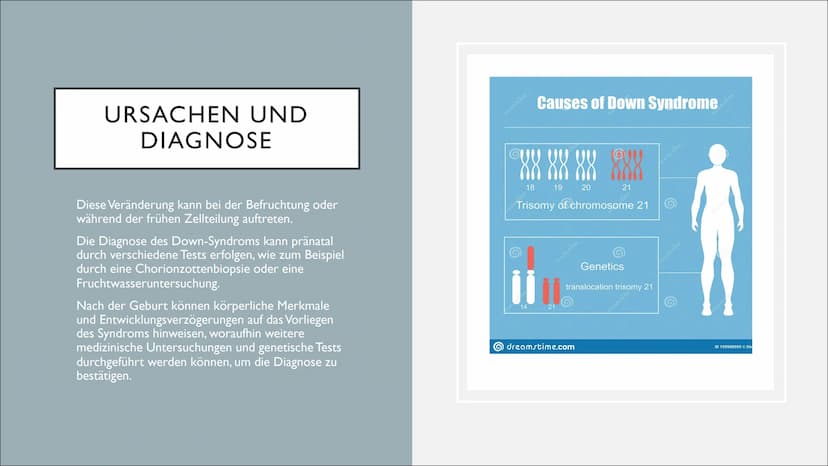 DOWN SYNDROM GLIEDERUNG
Was ist das down-syndrom?
Ursachen und diagnose
Symptome und merkmale
Therapie
Herausforderungen und Chancen
• Fakte