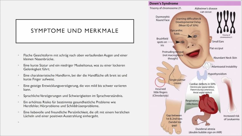 DOWN SYNDROM GLIEDERUNG
Was ist das down-syndrom?
Ursachen und diagnose
Symptome und merkmale
Therapie
Herausforderungen und Chancen
• Fakte