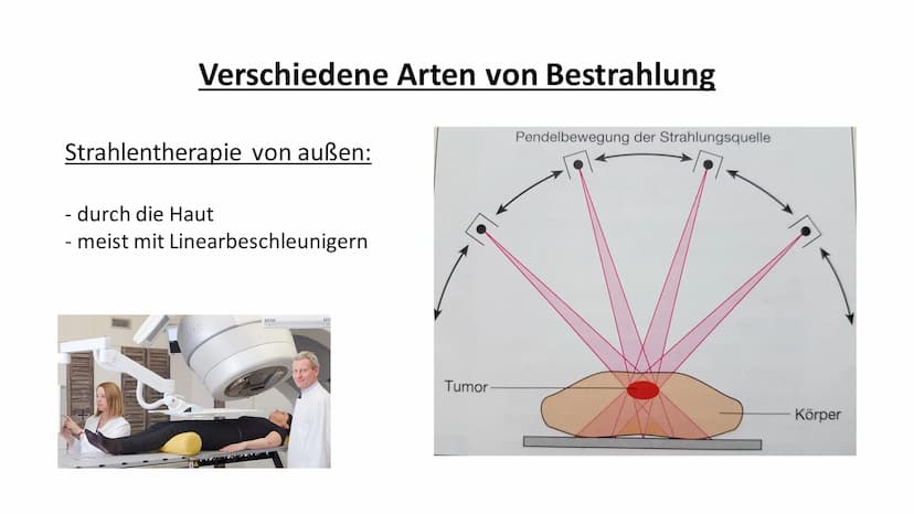 Medizinische
Anwendung
von Strahlung
Strahlentherapie Übersicht
1.Einleitung Strahlentherapie
2. Was passiert genau bei einer Strahlentherap
