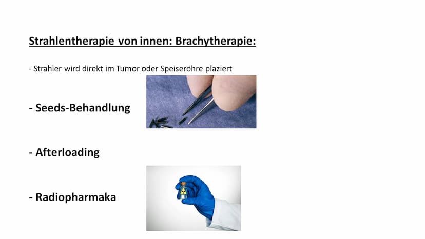 Medizinische
Anwendung
von Strahlung
Strahlentherapie Übersicht
1.Einleitung Strahlentherapie
2. Was passiert genau bei einer Strahlentherap