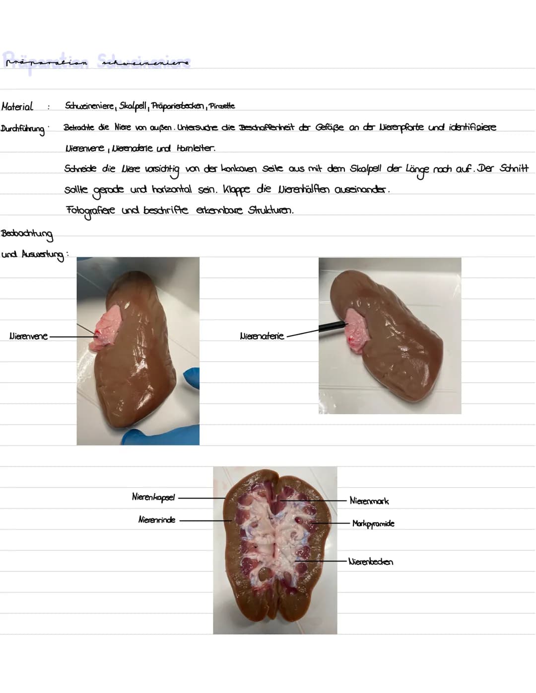Die niere
}
100 Gliederung
1. Präparation Diere
2. Aufbau und Lage der Niere
3. Funktion der Niere
4. Bau, Funktion und Lage des Nephrons
5.