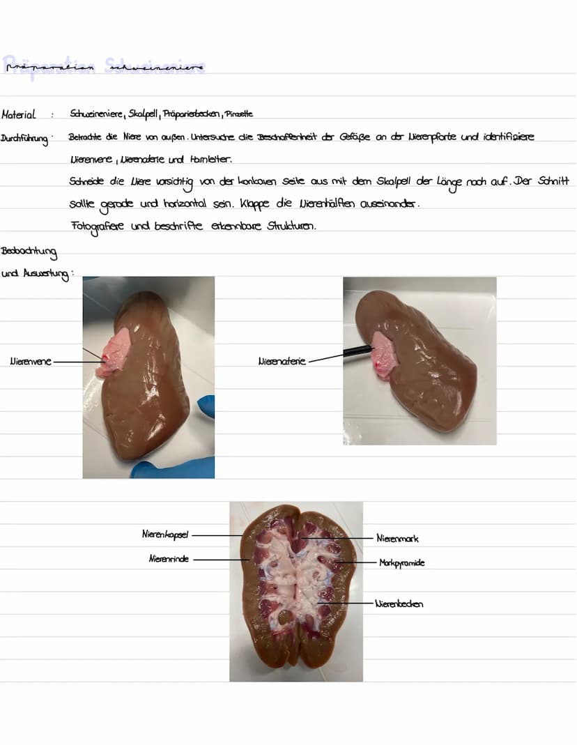 Die niere
}
100 Gliederung
1. Präparation Diere
2. Aufbau und Lage der Niere
3. Funktion der Niere
4. Bau, Funktion und Lage des Nephrons
5.