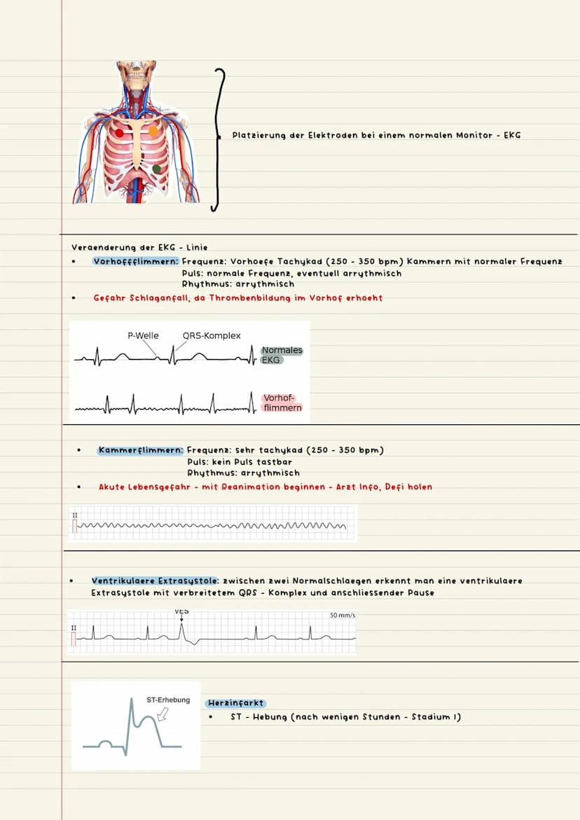 Vitalparameter
Objektive Patienten beobachtung
objektiv messbar, alles was mit Zahlen zu tun hat
-Ekg (Elektrokardiogramm)
-Puls
Jessis
●
-A