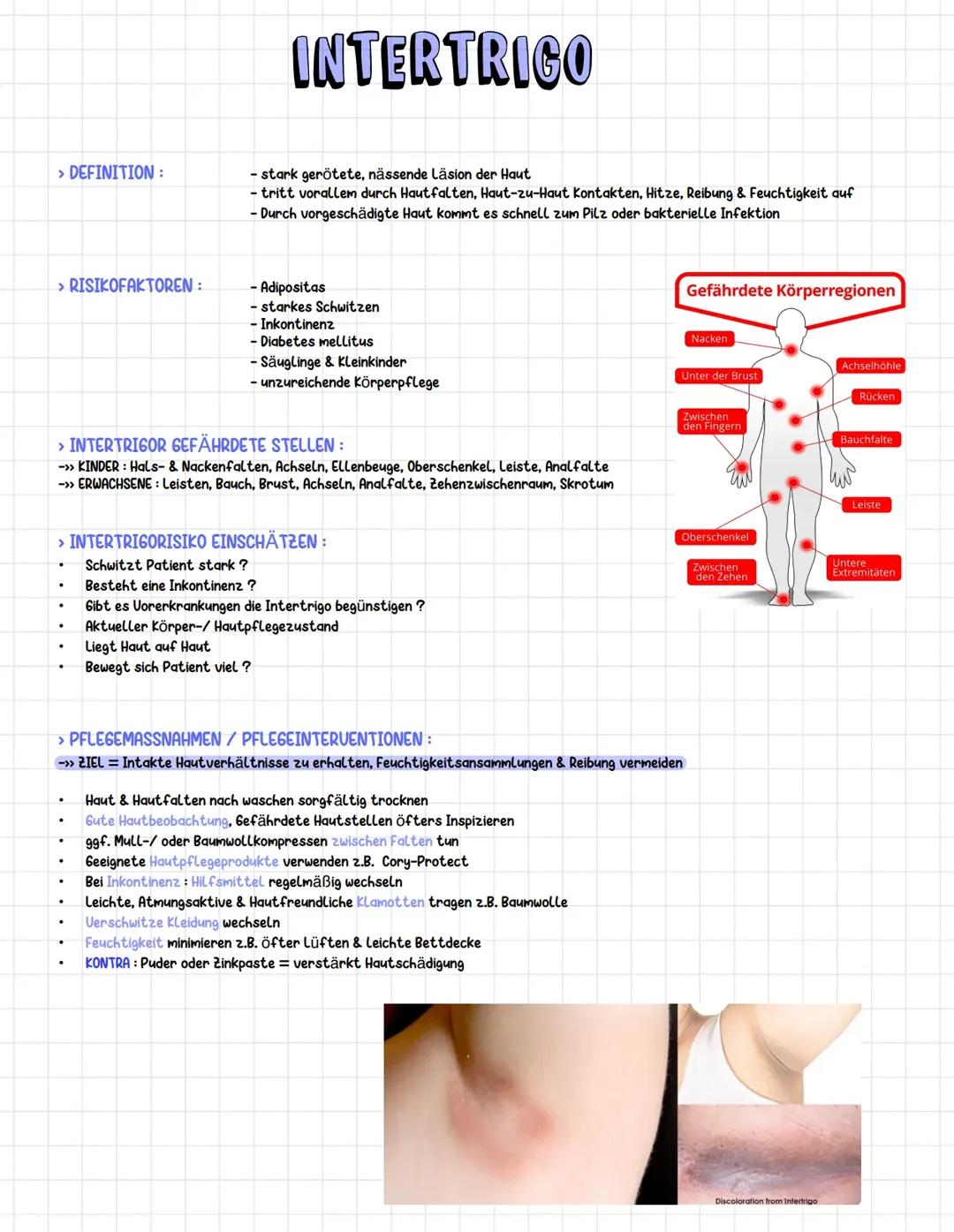 Intertrigoprophylaxe