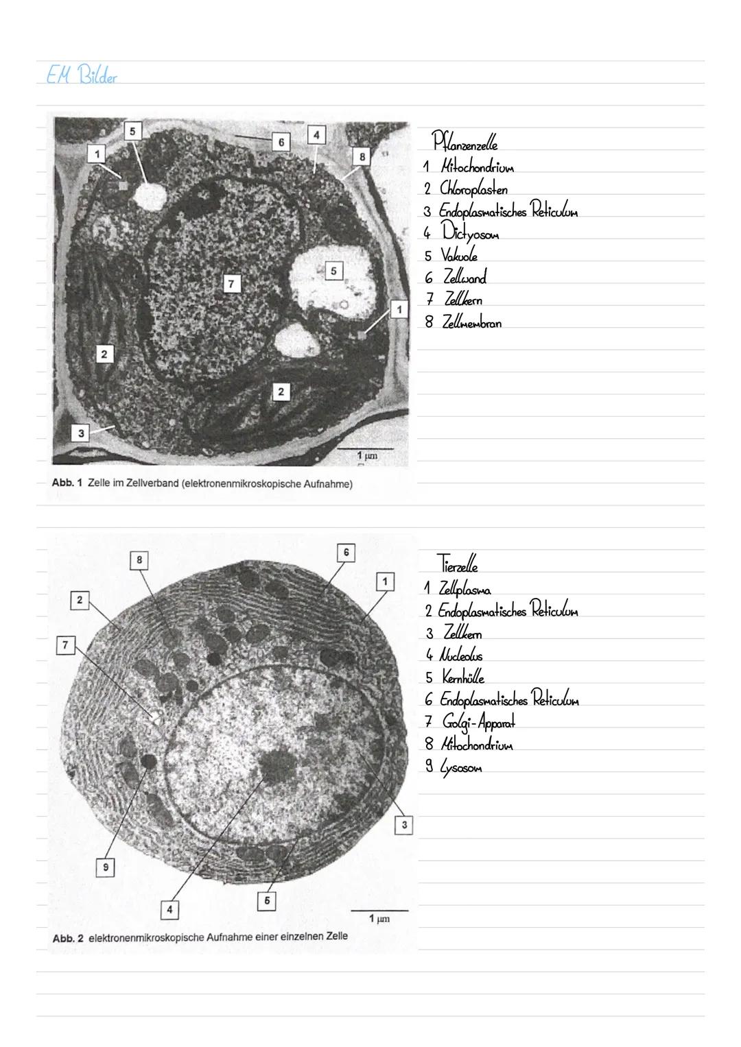 EM Bilder
3
7
2
2
5
9
7
Abb. 1 Zelle im Zellverband (elektronenmikroskopische Aufnahme)
8
2
5
4
5
6
Abb. 2 elektronenmikroskopische Aufnahme