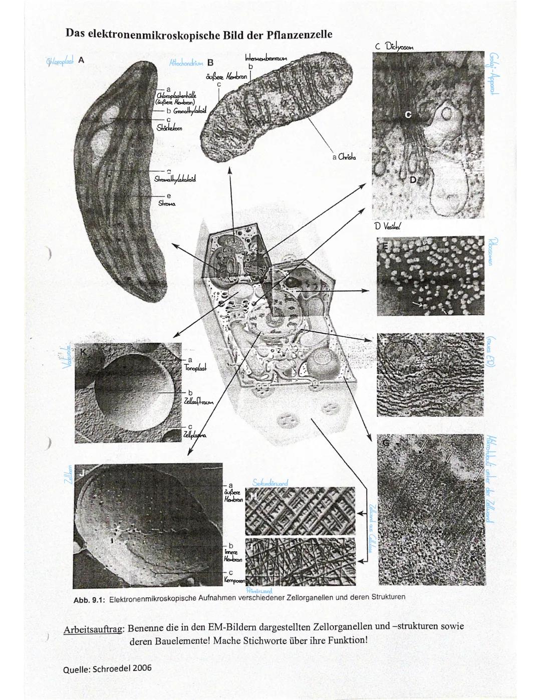 EM Bilder
3
7
2
2
5
9
7
Abb. 1 Zelle im Zellverband (elektronenmikroskopische Aufnahme)
8
2
5
4
5
6
Abb. 2 elektronenmikroskopische Aufnahme