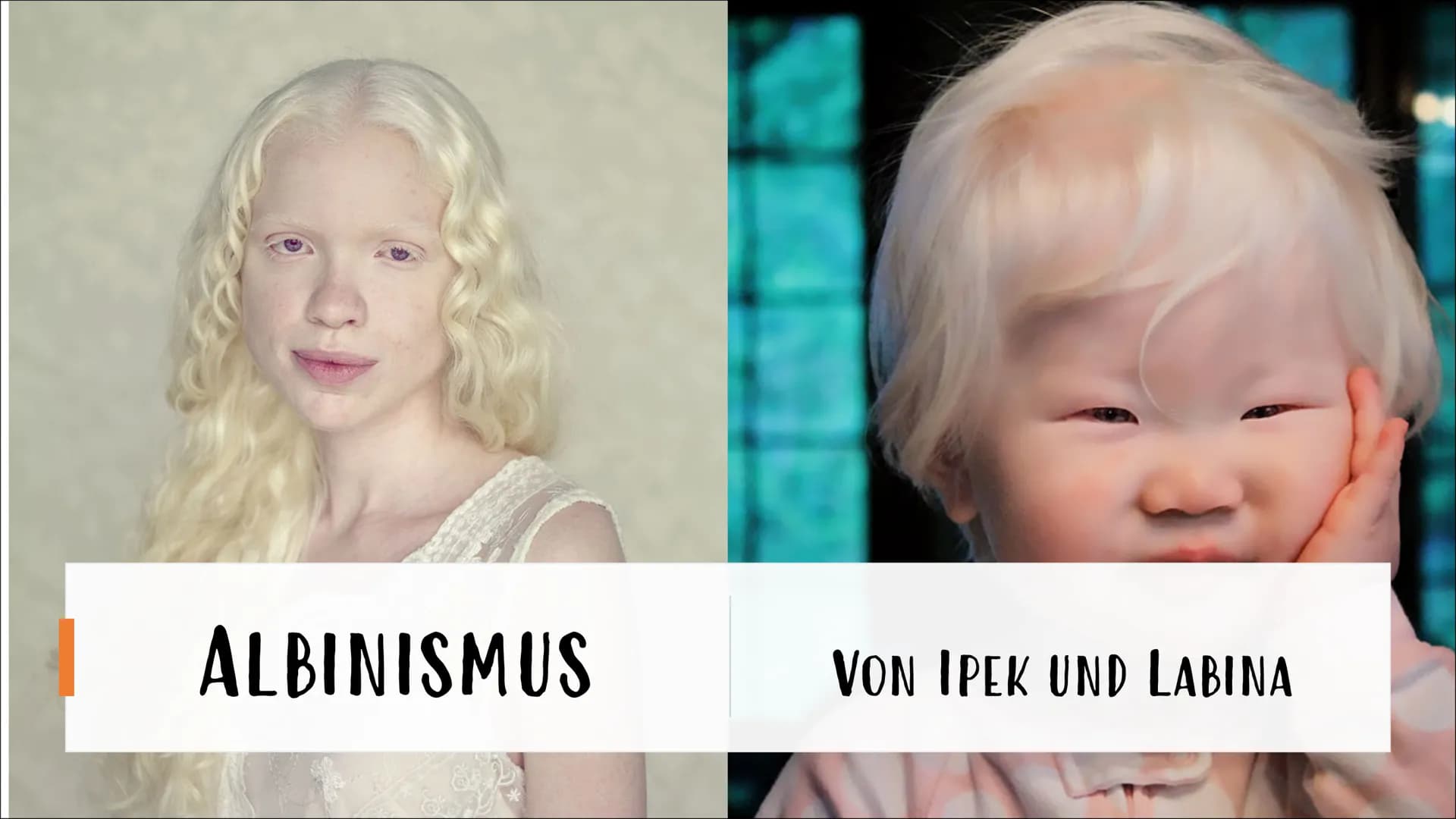 ALBINISMUS
BY
VON IPEK UND LABINA AGENDA:
Was ist Albinismus?
Albino Menschen
Albino Tiere
Familienbaumstamm der Albinus
Symptome und Beschw