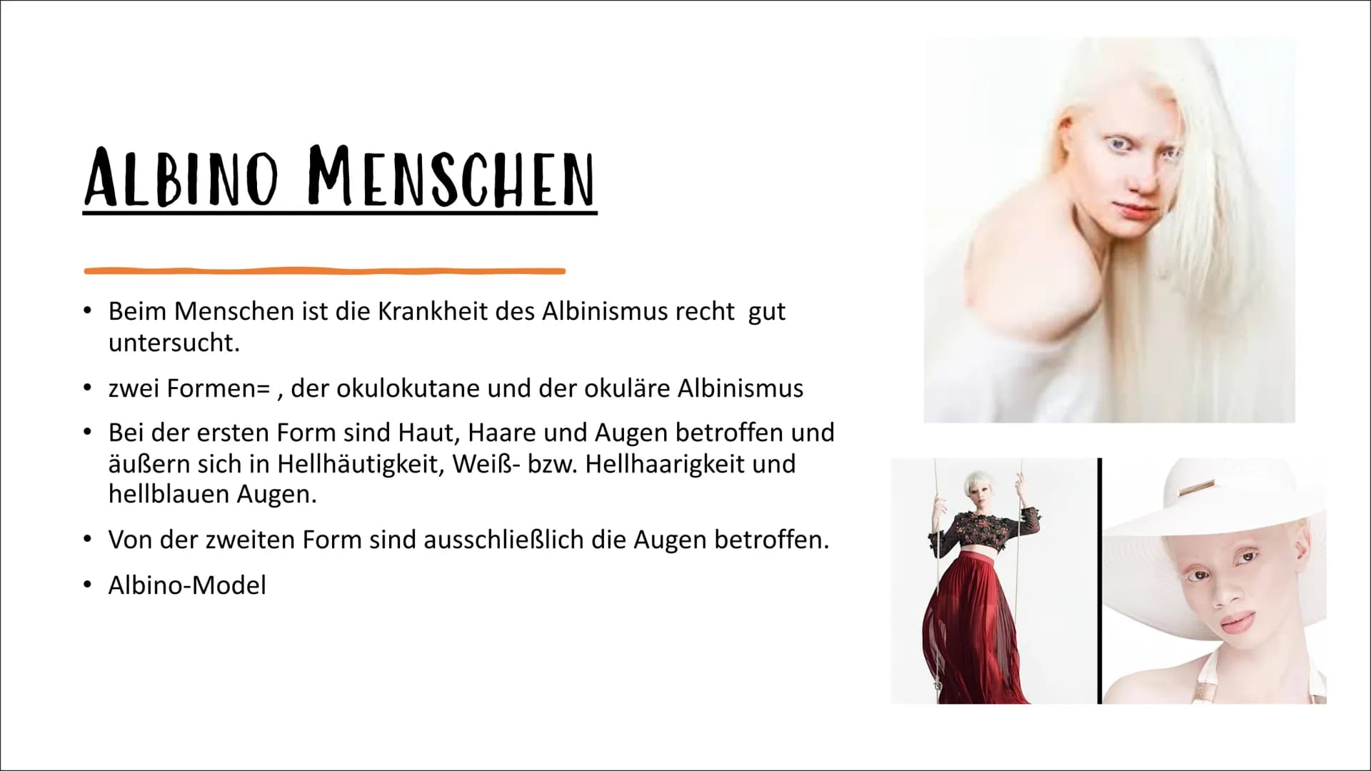 ALBINISMUS
BY
VON IPEK UND LABINA AGENDA:
Was ist Albinismus?
Albino Menschen
Albino Tiere
Familienbaumstamm der Albinus
Symptome und Beschw