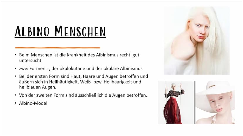 ALBINISMUS
BY
VON IPEK UND LABINA AGENDA:
Was ist Albinismus?
Albino Menschen
Albino Tiere
Familienbaumstamm der Albinus
Symptome und Beschw