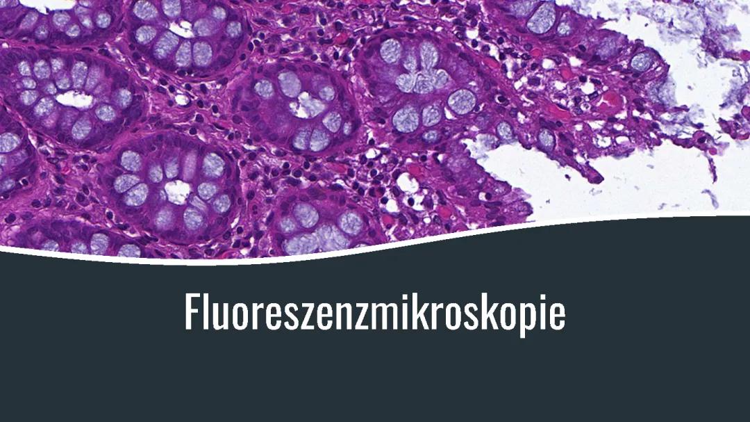 Fluoreszenzmikroskopie Präsentation Biologie