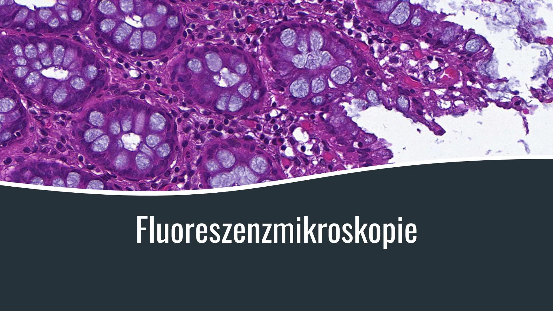 Fluoreszenzmikroskopie Was ist die Fluoreszenzmikroskopie?
Variante der Lichtmikroskopie
ein Stoff wird von einem (Anregungs-) Licht bestrah